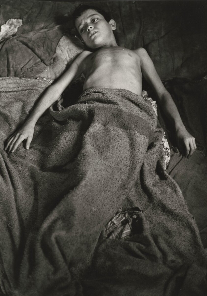 Flavio da Silva After Asthma Attack, the Favela