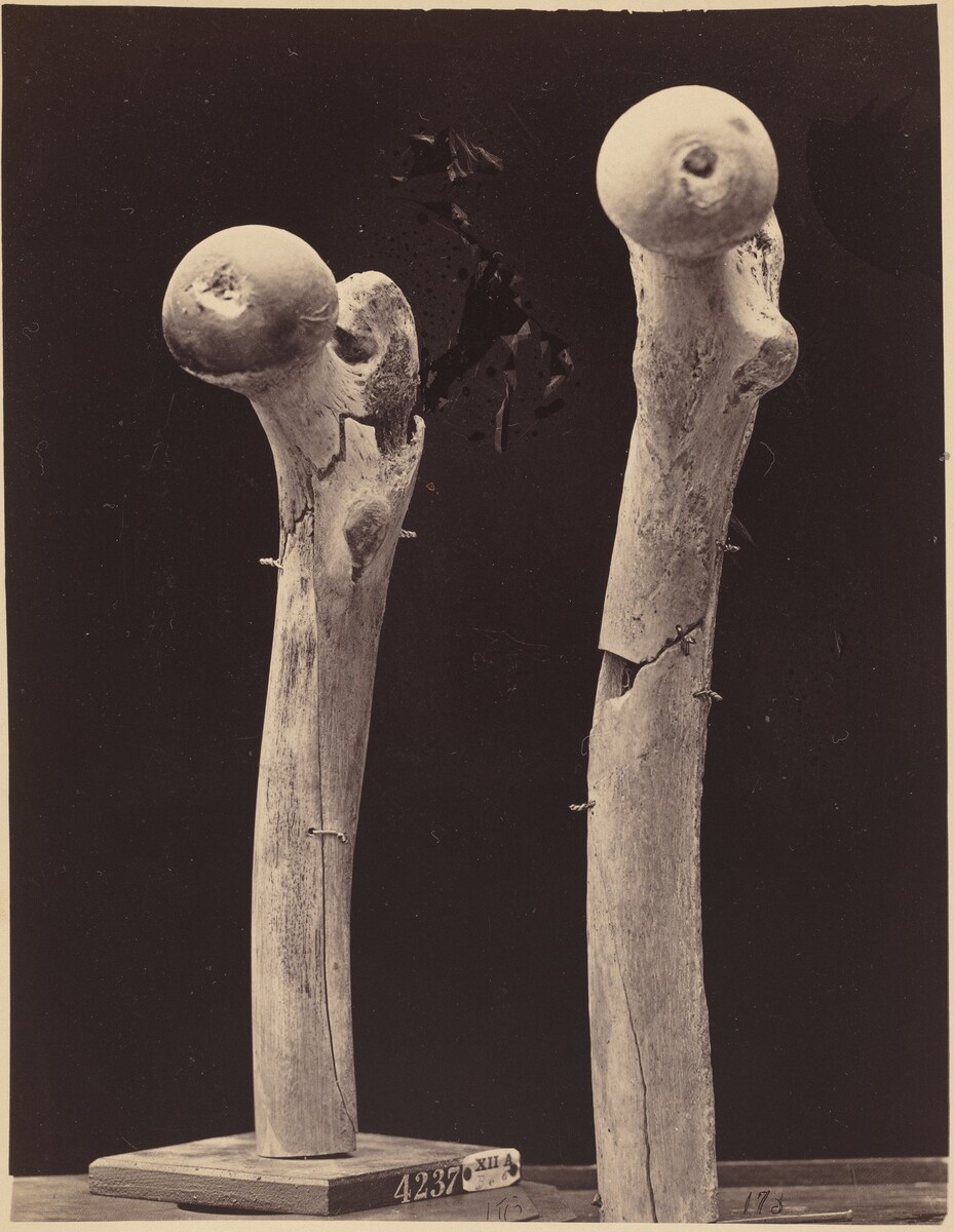 This is a photograph of two wooden walking staffs or canes. The image features two elongated objects with bulbous, rounded tops that resemble natural wooden staffs. Each staff is mounted on a simple wooden base against a dark, neutral background. The wooden surfaces display an intricate pattern of natural wood grain and knots, with visible cracks and irregularities. The photograph emphasizes the tactile and organic qualities of the wooden objects, showcasing their simplicity and rustic beauty. The stands at the bottom have numbered tags.