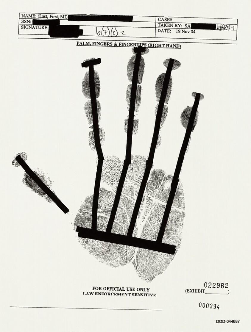 PALM, FINGERS & FINGERTIPS (RIGHT HAND) 000394