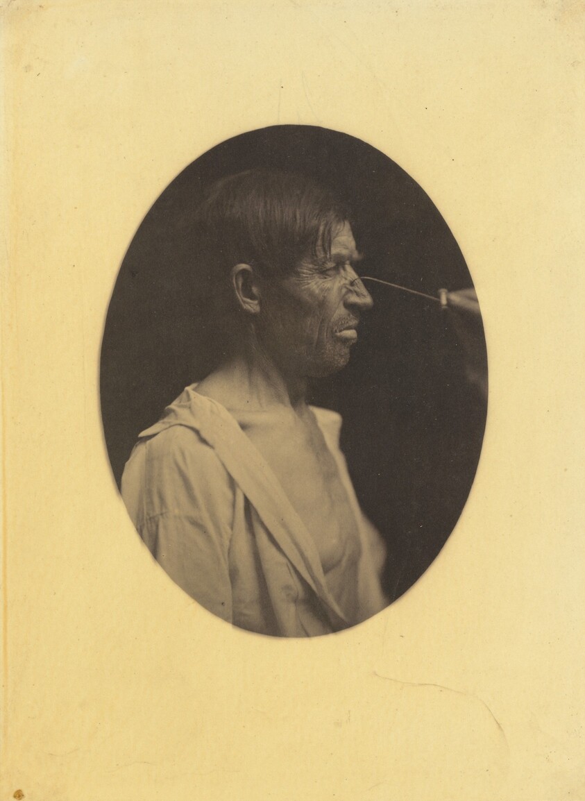 Bad humor, malcontentment