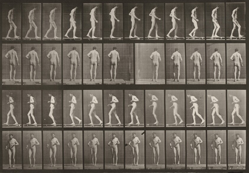 Plate Number 548. Lateral sclerosis, walking