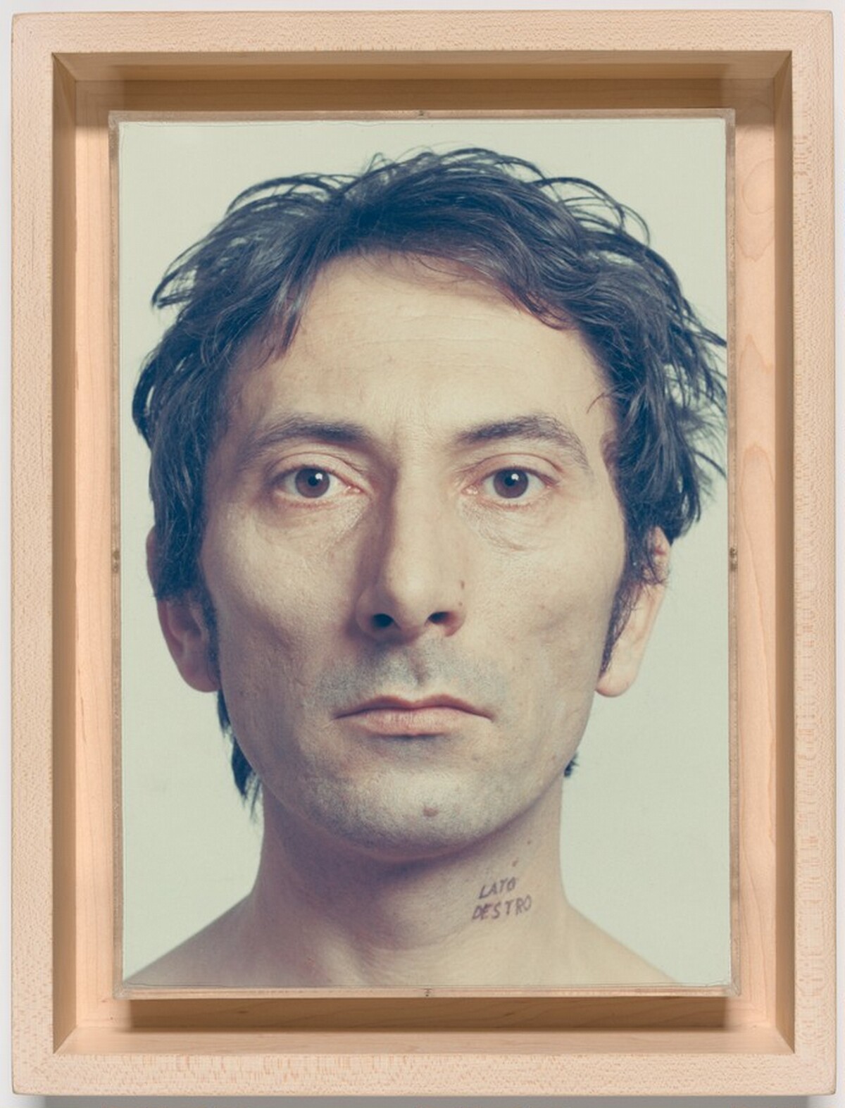 Lato Destro (Right Side)