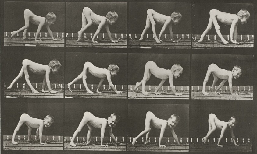 Plate Number 539. Infantile paralysis, child walking on hands and feet