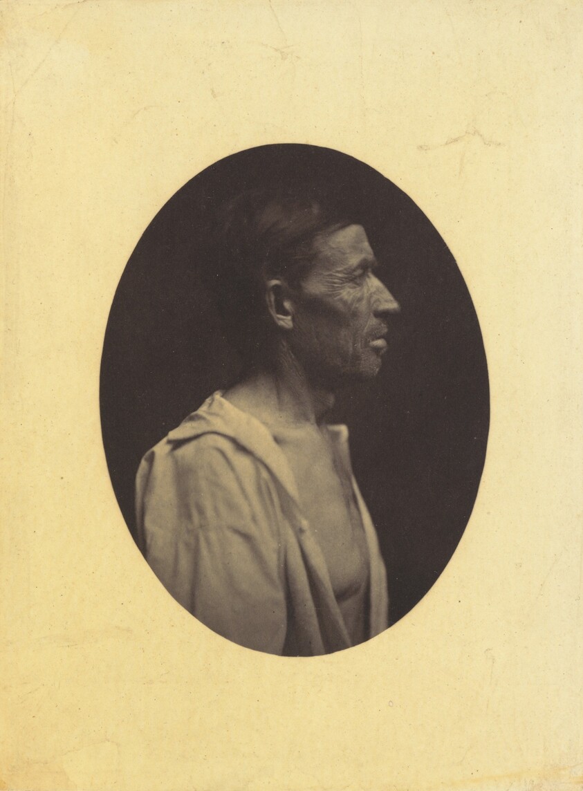 A portrait, seen in profile, of a man 42 years old, stupefied by the abuse of alcohol; his nose is aquiline