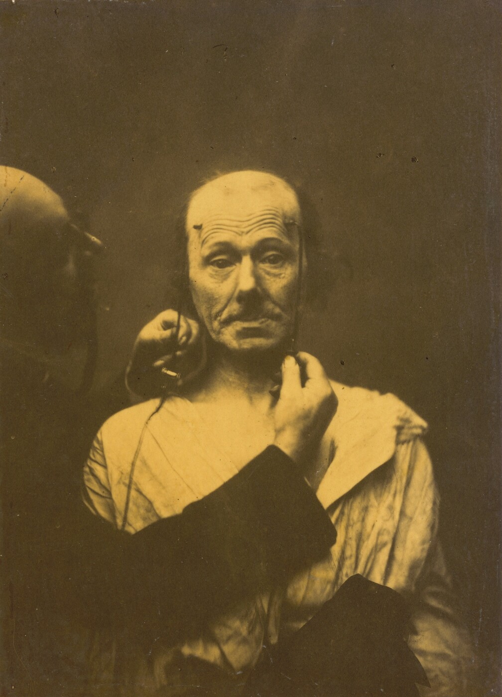 The image shows a person's upper body, focusing on their head and shoulders. The individual is seated upright, with their face aimed directly at the camera. They have a noticeable bald head, with wrinkles crossing their forehead. Their facial expression appears neutral, and they have drooping eyelids. Their clothing consists of a light-colored, loose-fitting garment. There is another figure partially visible to the left side of the frame, who seems to be wearing dark clothing. This person is obscured and only partially visible. The background is plain and dark.