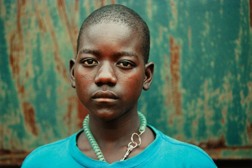 Dennis, Formerly Held by Rebels in the North of Uganda, Near Lira, Uganda