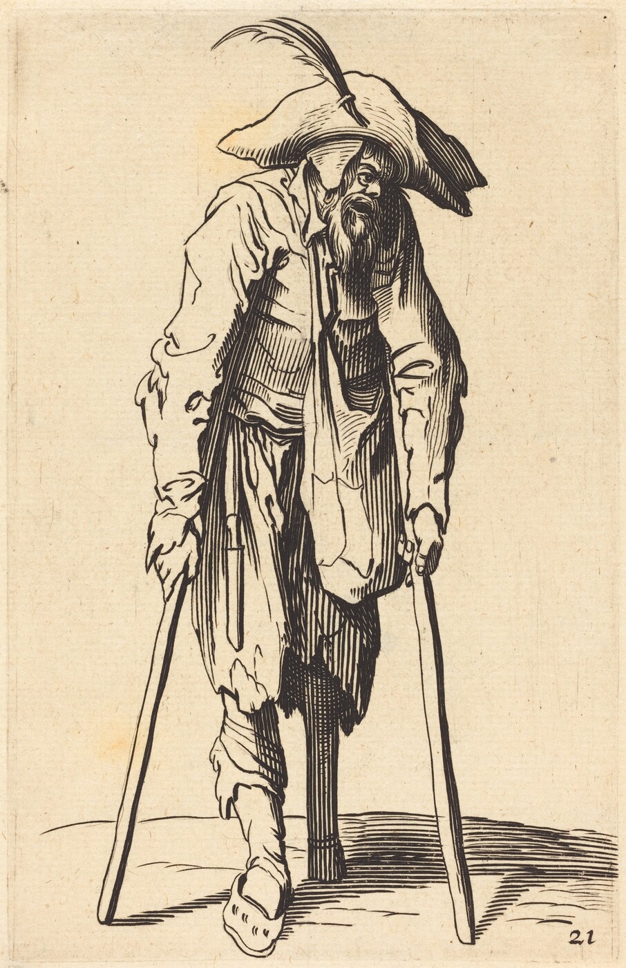 The image shows a person standing with crutches. The person has a beard, is wearing a hat with a feather, tattered clothing, and one foot in a sandal. The background is plain.