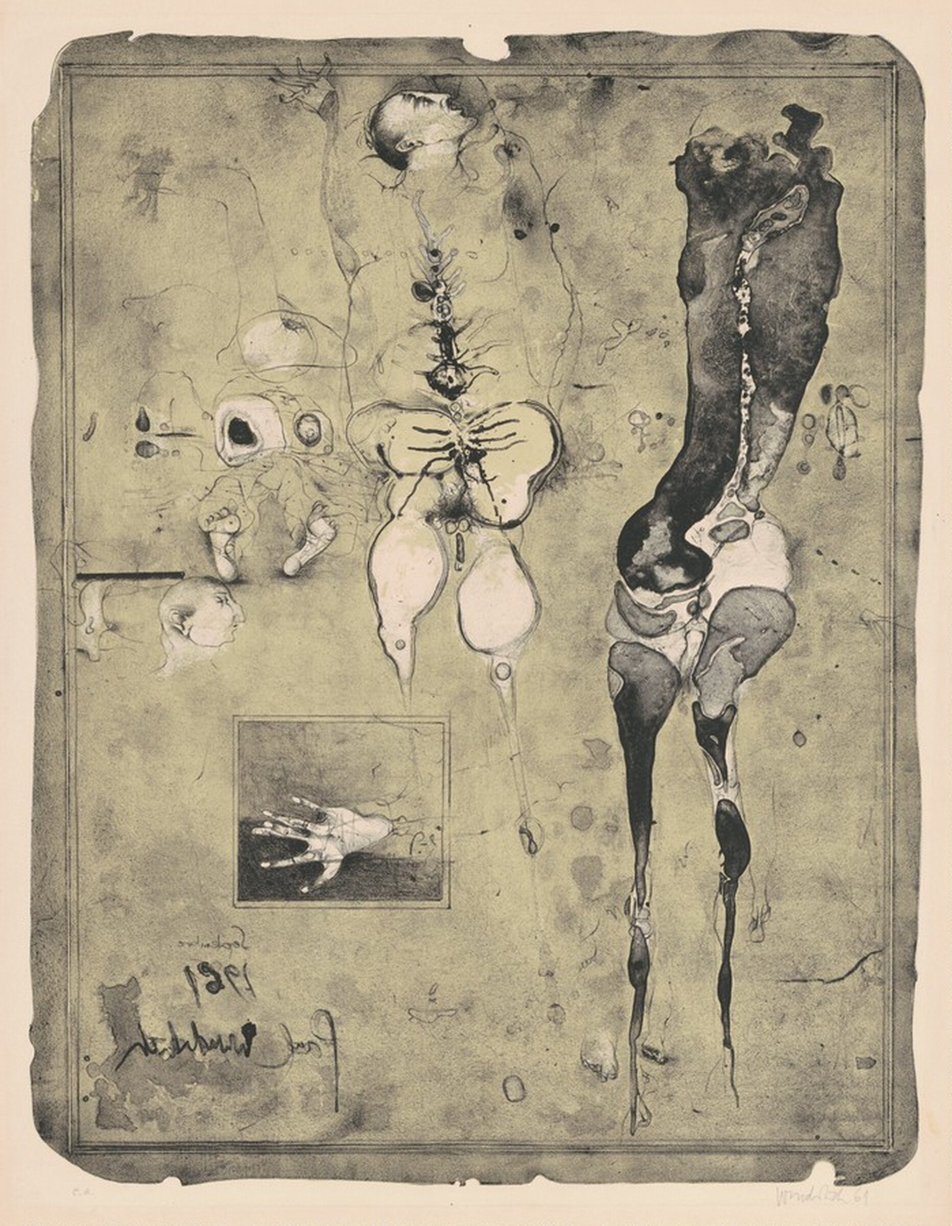 Anatomie 61 (Anatomy 61), Paul Wunderlich, 1961