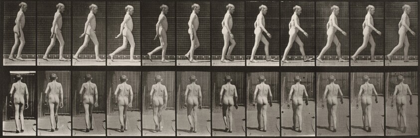 Plate Number 562. Lateral curvature of spine, walking