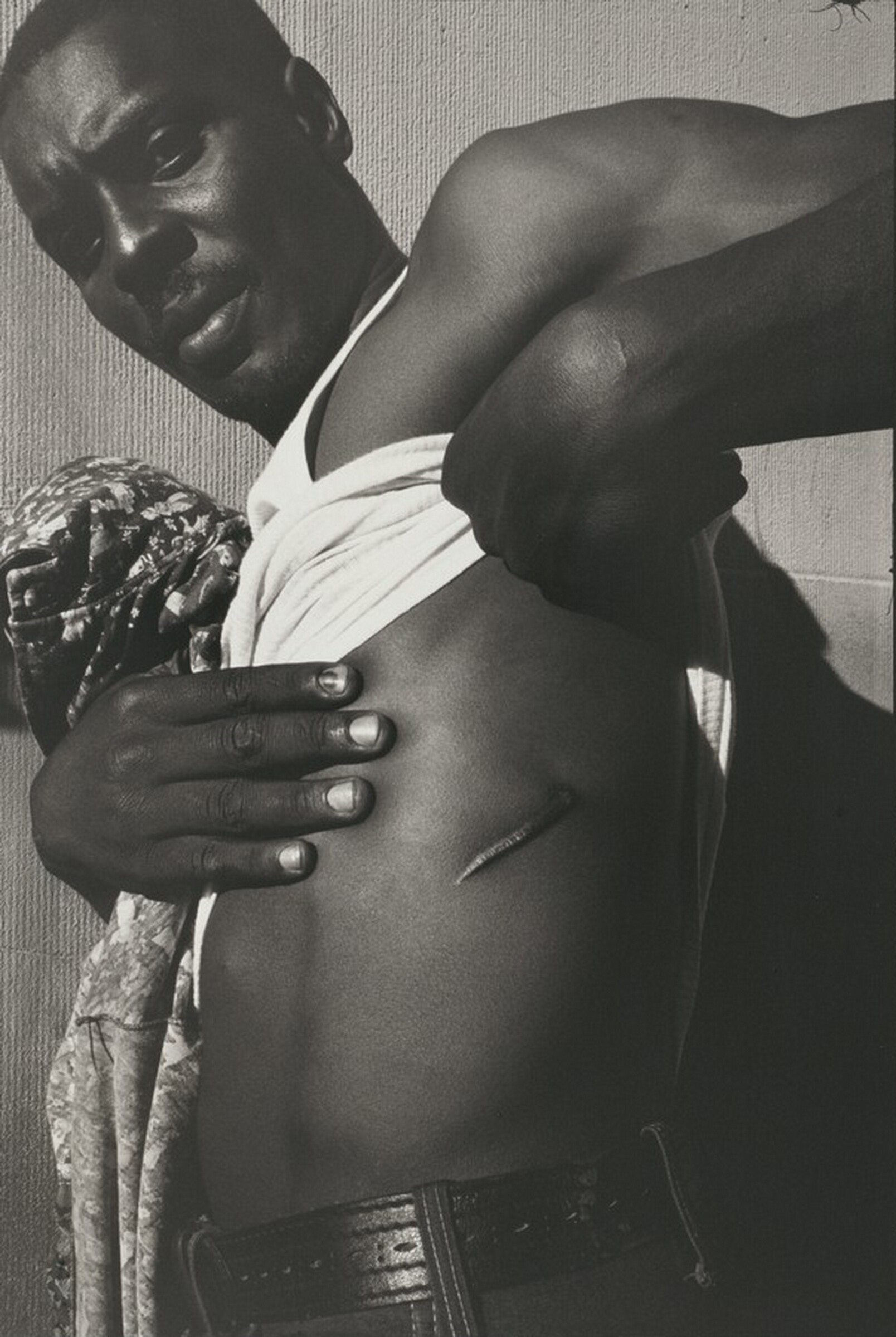 A 14th Street drug pusher shows one of his many knife wounds, shortly after this photo was taken he was stabbed again, New York City, Leonard Freed, 1978
