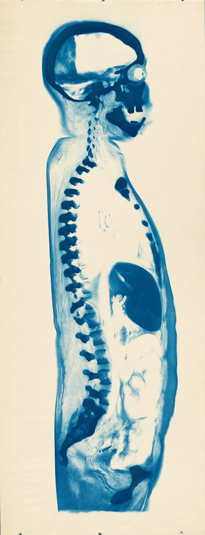 Cryogenic Section of a Cadaver