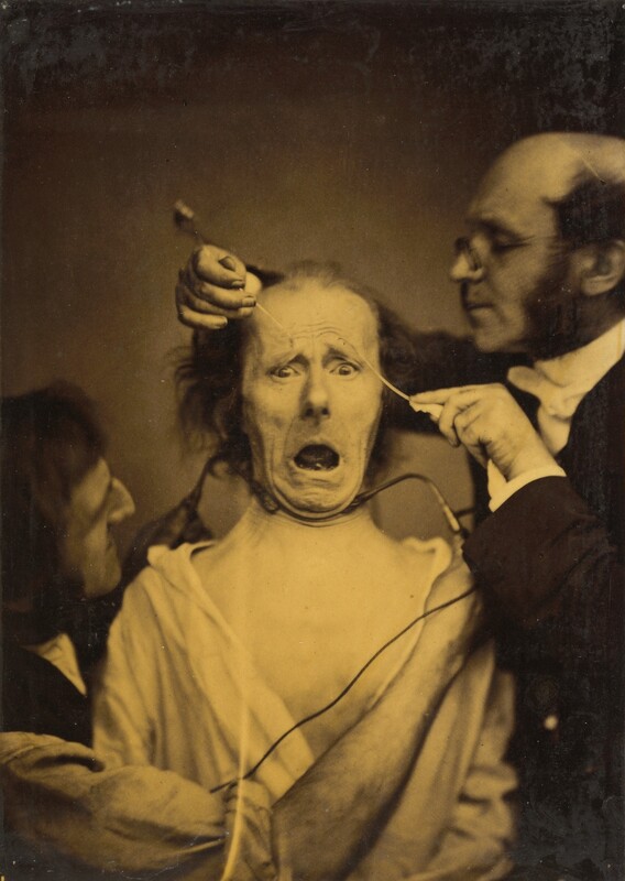 Two men apply rod-like devices to a third man, whose chin is pulled back, mouth wide open, and eyebrows angled sharply upward in this vertical black and white photograph. Printed in tones of golden brown and black, the bare chest of the central man and his white shirt stand out against the shadowy background. To our left, one man wears a black vest over a white shirt with the sleeves rolled up to the elbows. He holds rods to either side of the central man’s neck. To our right, another man wears a dark suit, white tie, and spectacles perched at the end of his nose. He holds two rods to the central man’s eyebrows. All three men appear to have pale skin and dark hair with prominent mutton chops.