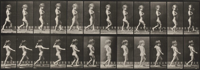 Plate Number 540. A: Bowlegs, boy. B: Spinal caries, girl walking