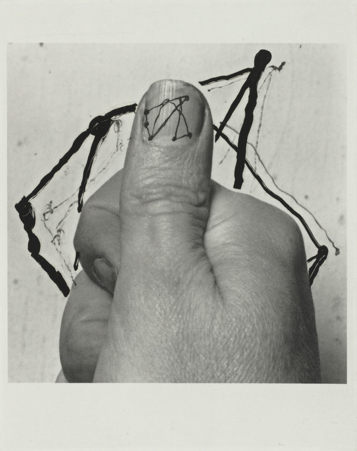 E. (All Thumbs)