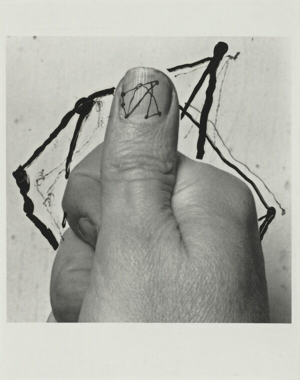 E. (All Thumbs)