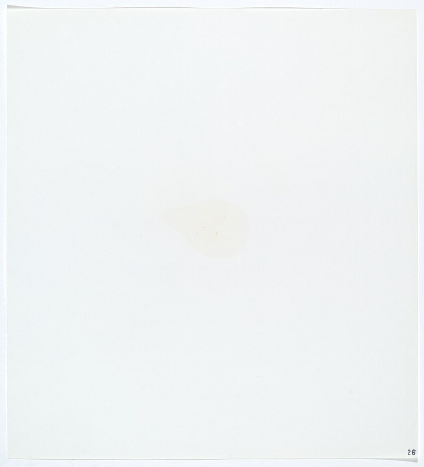 Stains: Glacial Acetic Acid (Robinson)